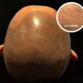 Micro haar pigmentatie ingezoomd / close-up
