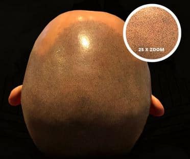 Continue reading Micro haar pigmentatie ingezoomd / close-up Micro haar pigmentatie ingezoomd / close-up.